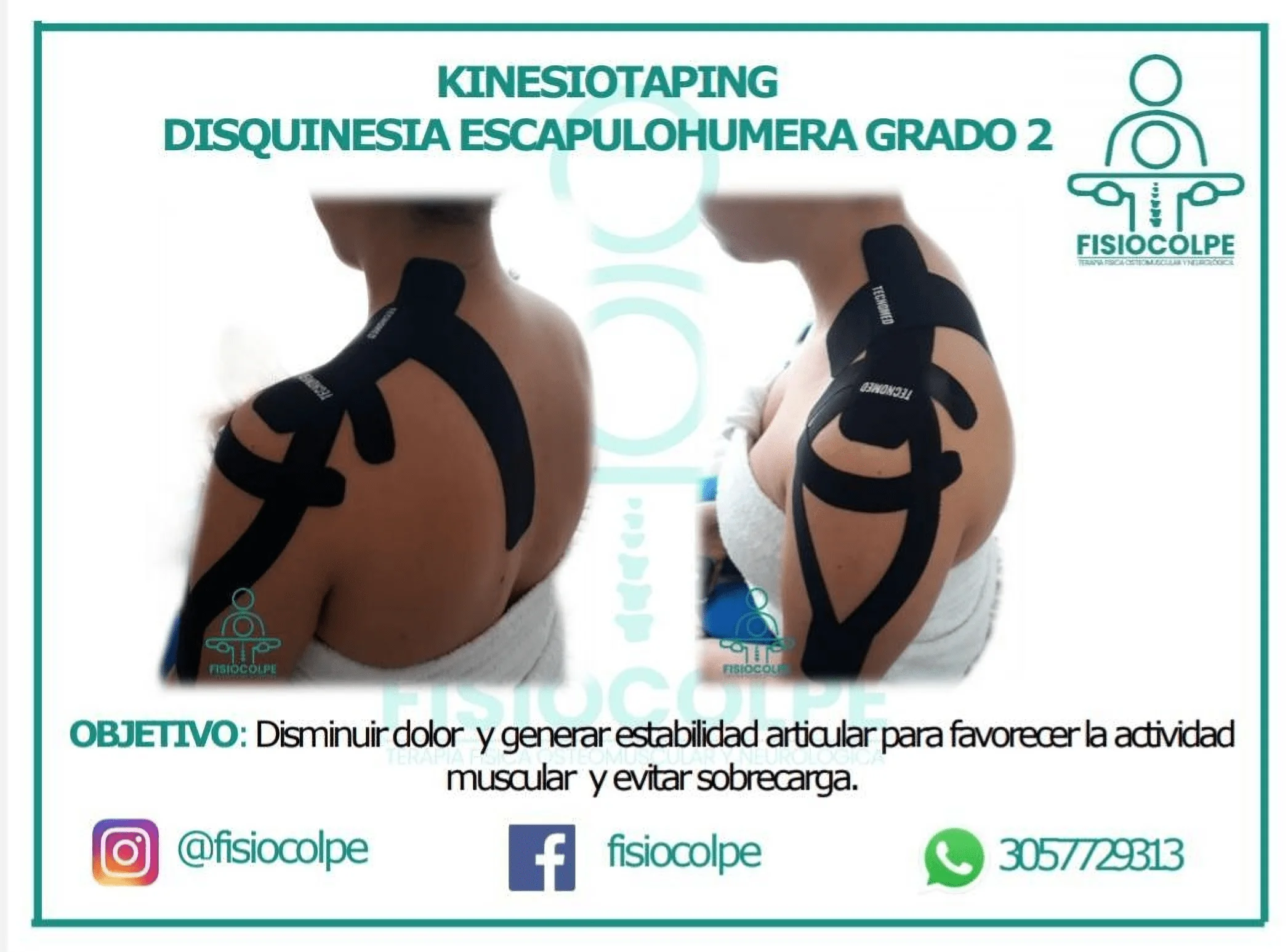 Terapia Fisica-fisiocolpe-9432